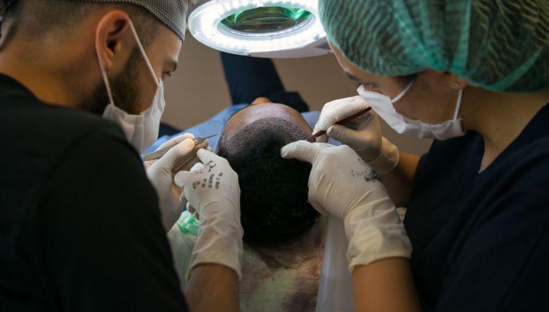 Hair Transplant in India